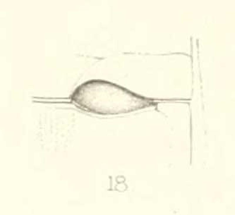 Diomus dohertyi 1st abdominal segment & metasternum 1894